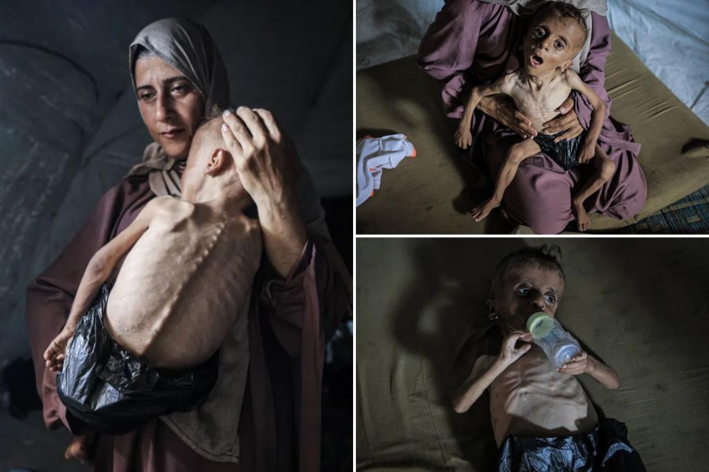 Images of a starving boy in Gaza don't reveal the complete picture, as critics point out he has genetic disorders.