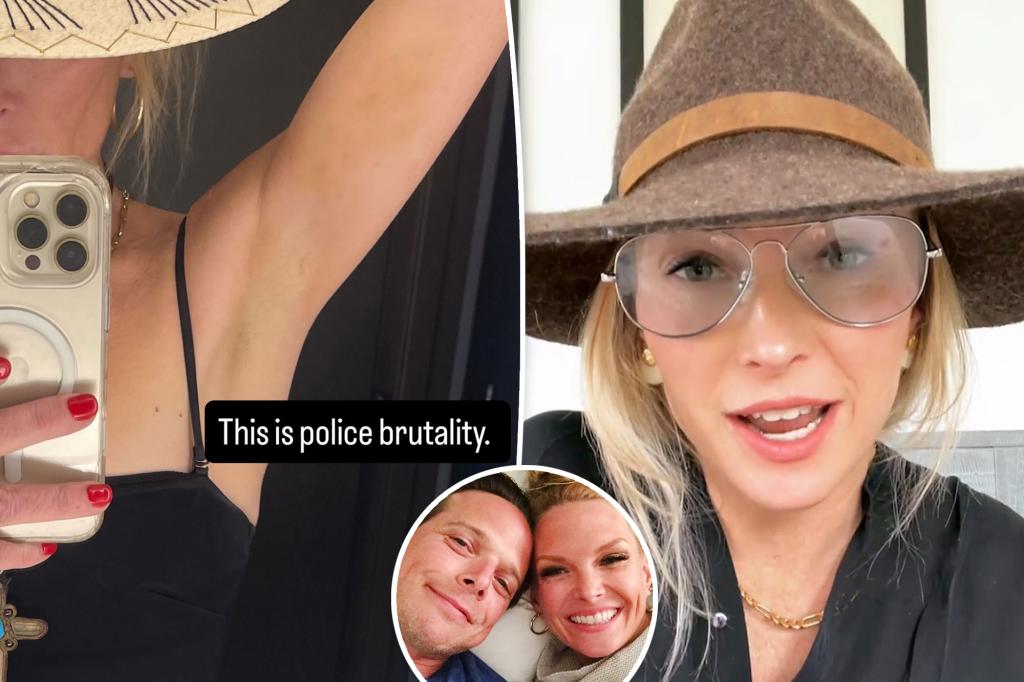Kelley, the estranged wife of Scott Wolf, speaks out against alleged 'police brutality' following a second 'involuntary hold.'