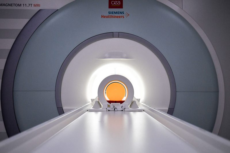 Man passes away after getting caught in MRI machine with metal chain on
