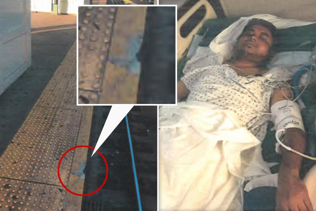 Man who lost five toes in transit accident awarded $22.75 million verdict