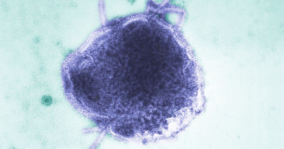 Measles exposure at day care requires Iowa family to miss weeks of work for their baby: 'It only takes one'