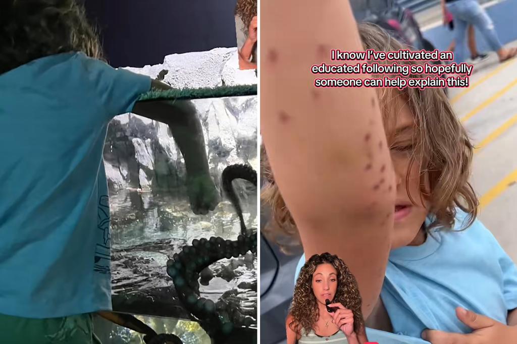 Mother says octopus attacked her 6-year-old son at Texas aquarium