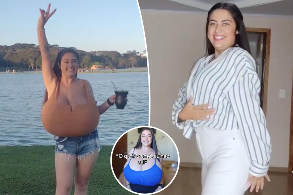 My breasts expanded uncontrollably because of an extremely rare condition.