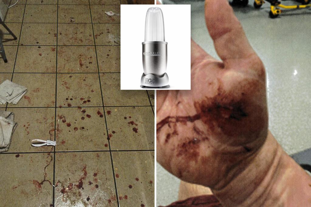 NYC man sues after Nutribullet explosion caused severed artery