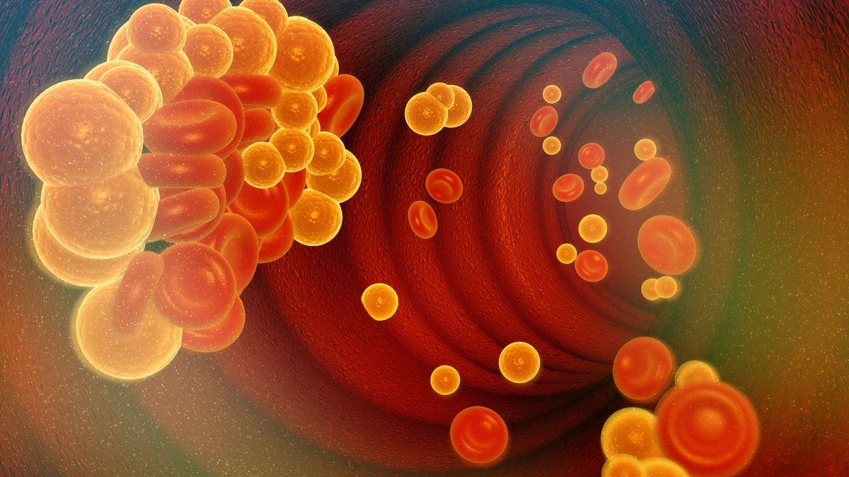 New approach to treat high cholesterol modifies DNA to lower LDL levels.