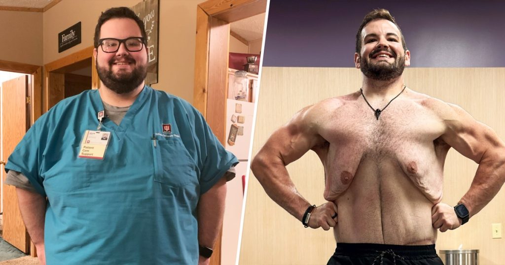 Nurse Loses 270 Pounds Through Bariatric Surgery, Diet, and Weightlifting