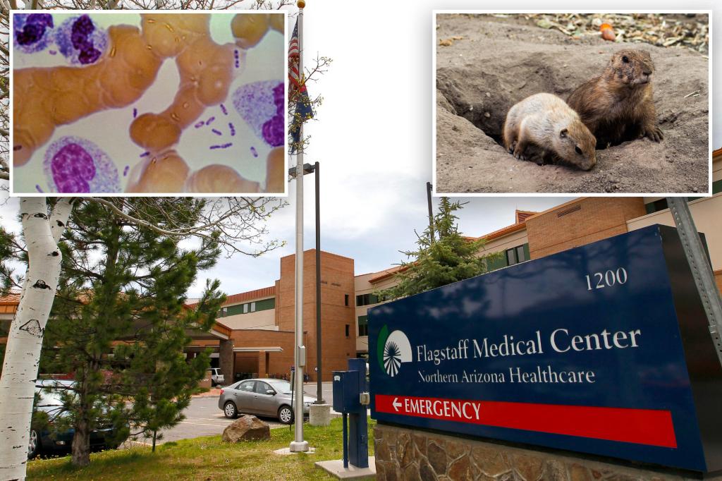Patient in Arizona dies from plague soon after a die-off of prairie dogs, an event health officials were watching closely