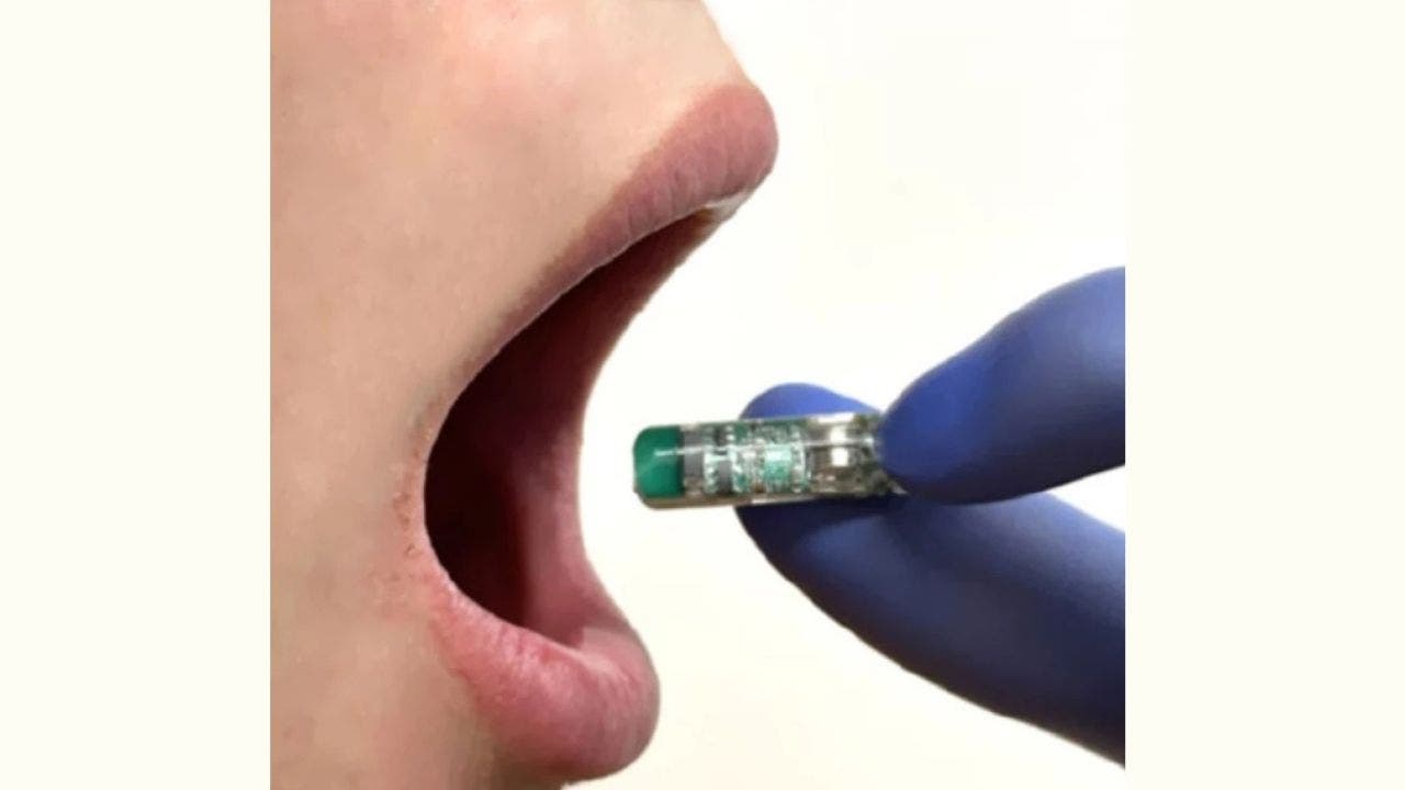 PillTrek's smart capsule provides instant wireless monitoring of gut health.