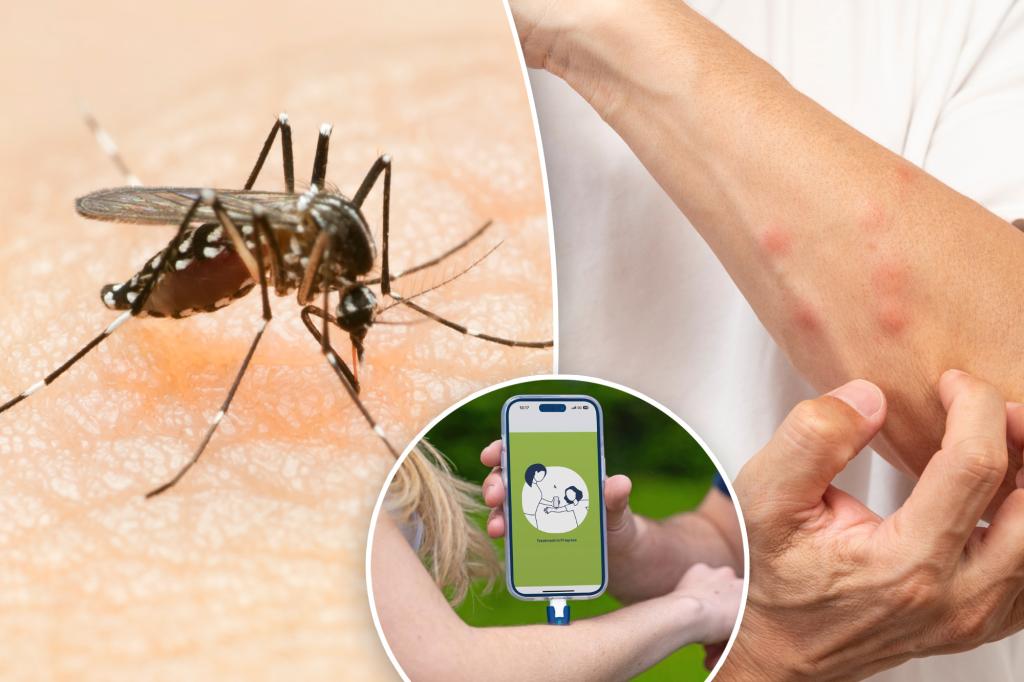 Quickly relieve itching with this new phone-operated bug bite zapper