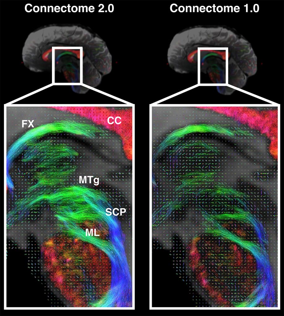 Researchers Create Advanced MRI Scanner to Identify Tiny Brain Structures