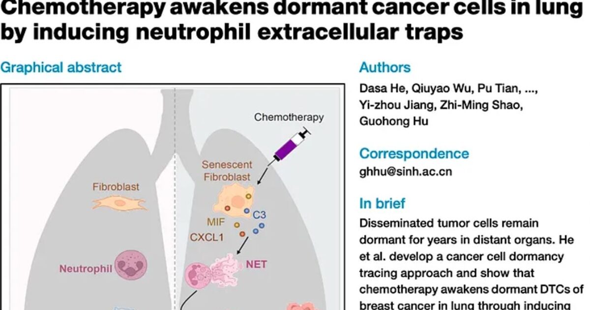 Surprising Research Indicates Chemotherapy Restores Inactive Cancer Cells – Causes Metastasis