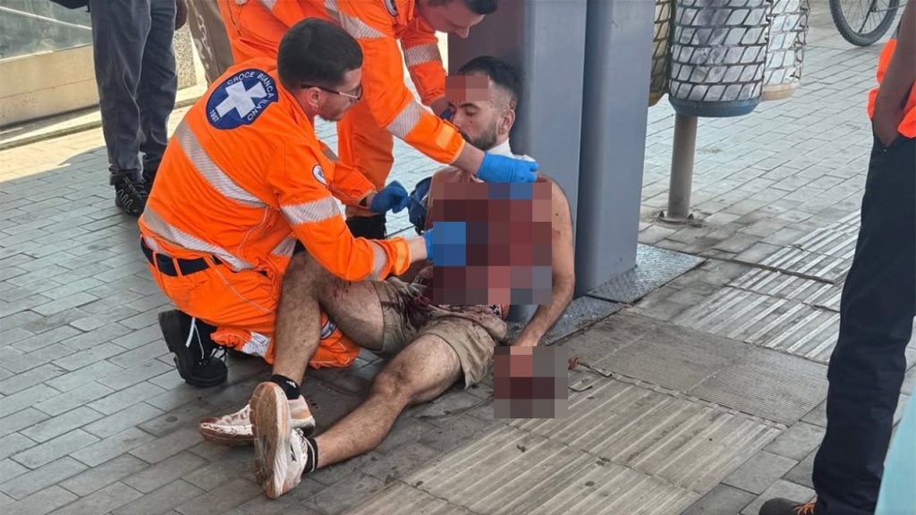 Teacher in San Francisco attacked in neck during train robbery in Italy