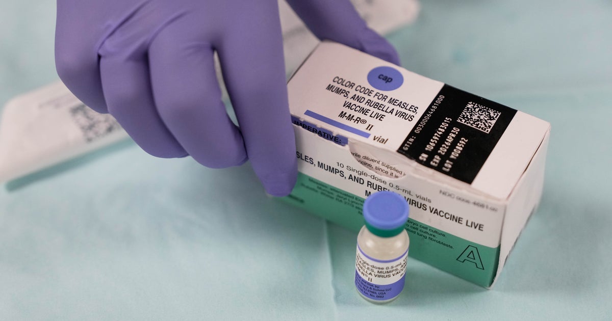 The Importance of the U.S. Losing Its Measles Elimination Status