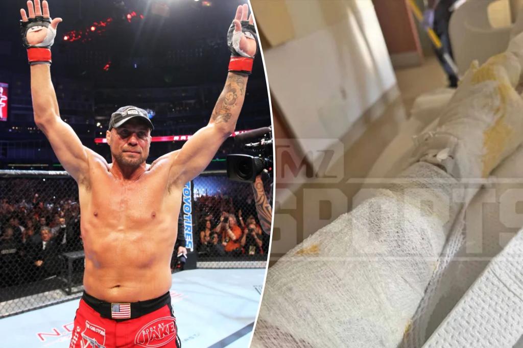 UFC icon Randy Couture flown to burn unit following NHRA accident