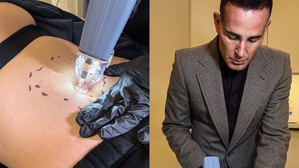 Ways to Address Loose Skin After Losing Weight