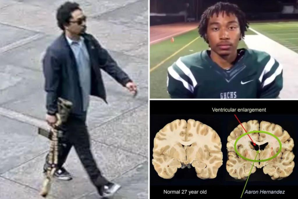 What is CTE? The brain disease that NYC shooter Shane Tamura said he had