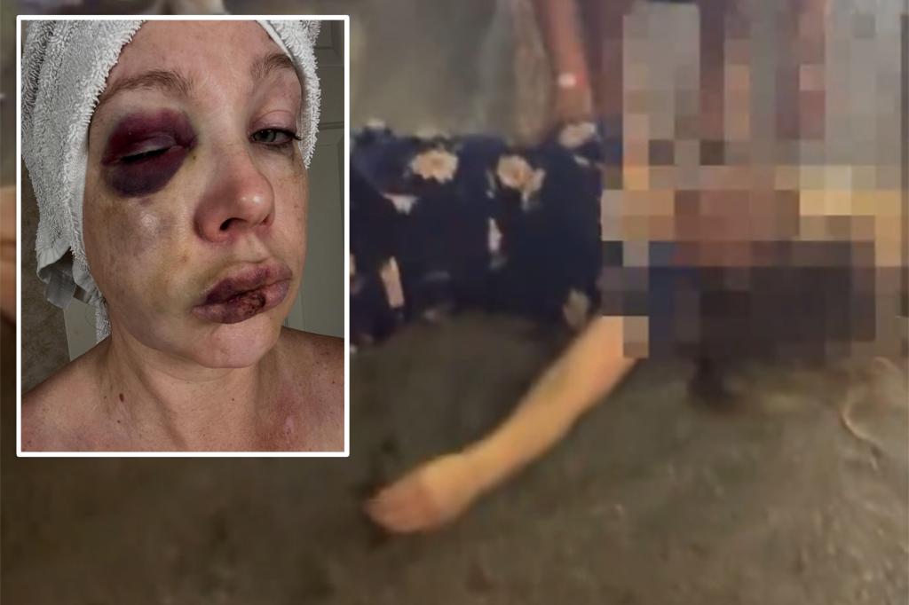 Woman assaulted in Cincinnati returns home, attacker's family says anger is rooted in race