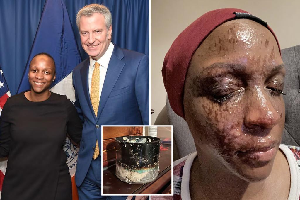 Woman critically injured when candle from Bath & Body Works burst