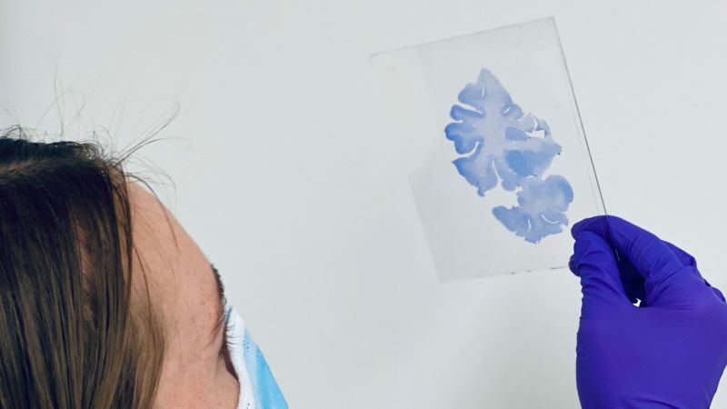 80-year-old 'Superager' brains function similarly to those of a 50-year-old. Here’s the reason.