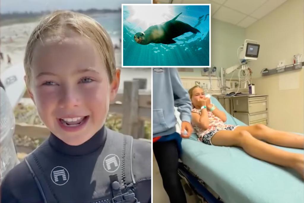 9-year-old surfer injured by sea lion during California camp
