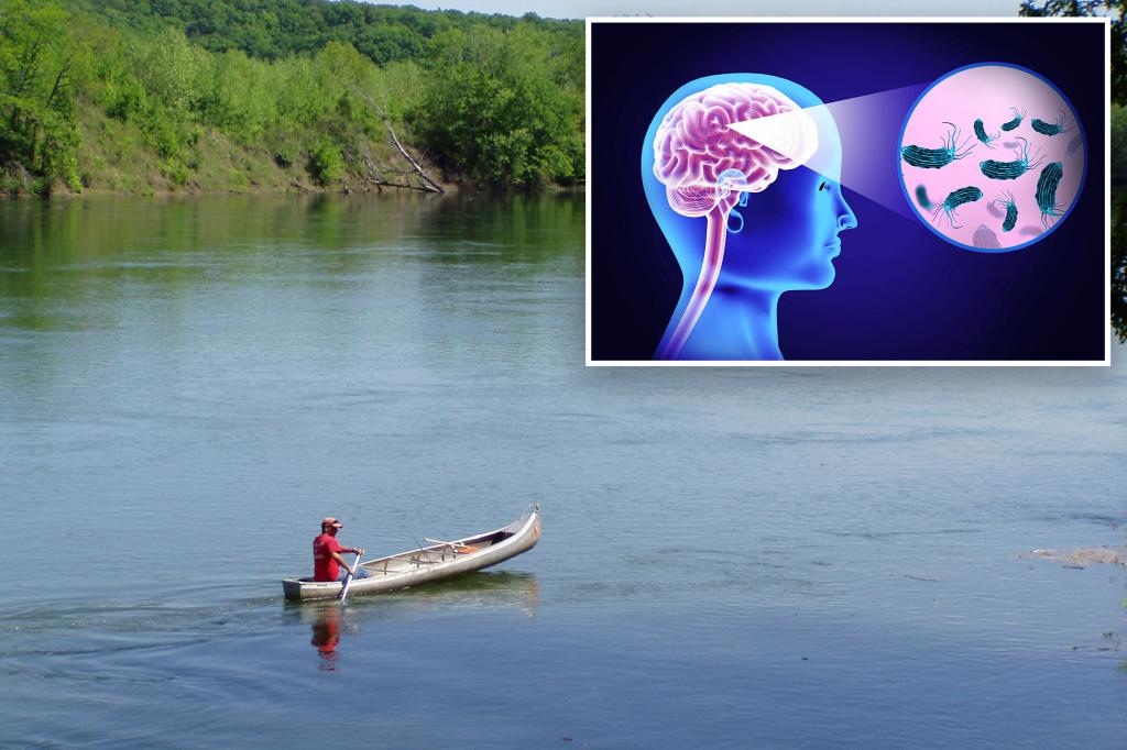 A Missouri patient dies from a brain-eating amoeba at a hospital in St. Louis.