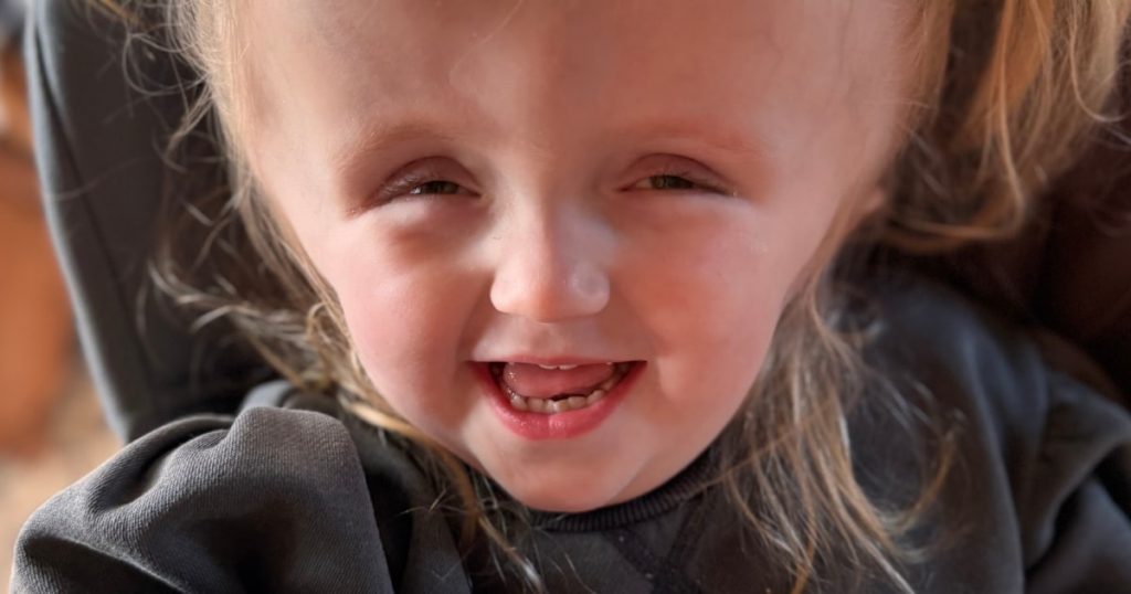 A Second Opinion Rescued Baby with Infant-Type Hemispheric Glioma