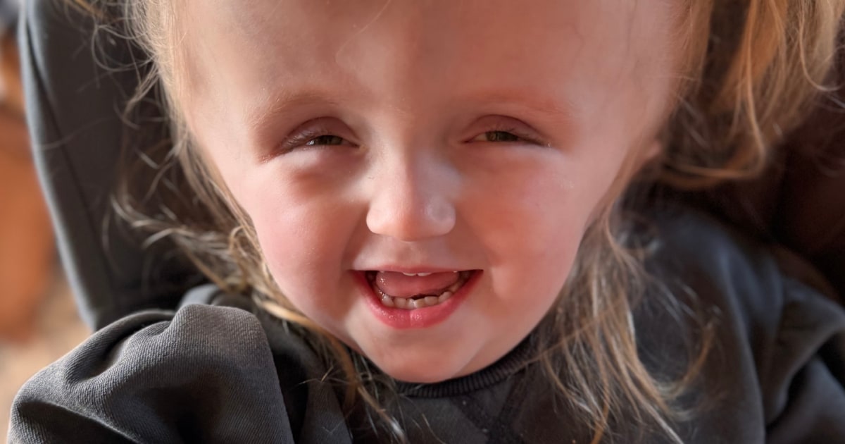 A Second Opinion Rescued Baby with Infant-Type Hemispheric Glioma