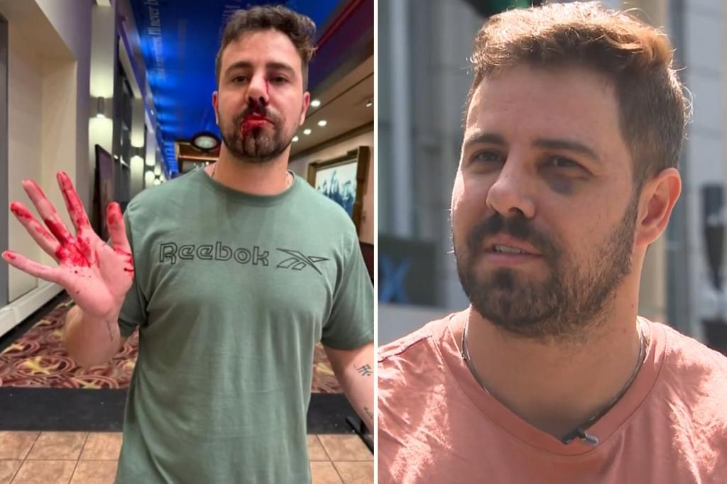 Angry Harvard researcher says he was attacked by a group of teenagers