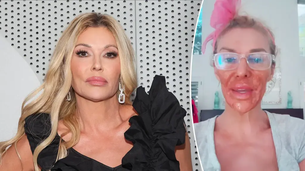 Brandi Glanville damages her face with Nair while addressing a facial parasite issue