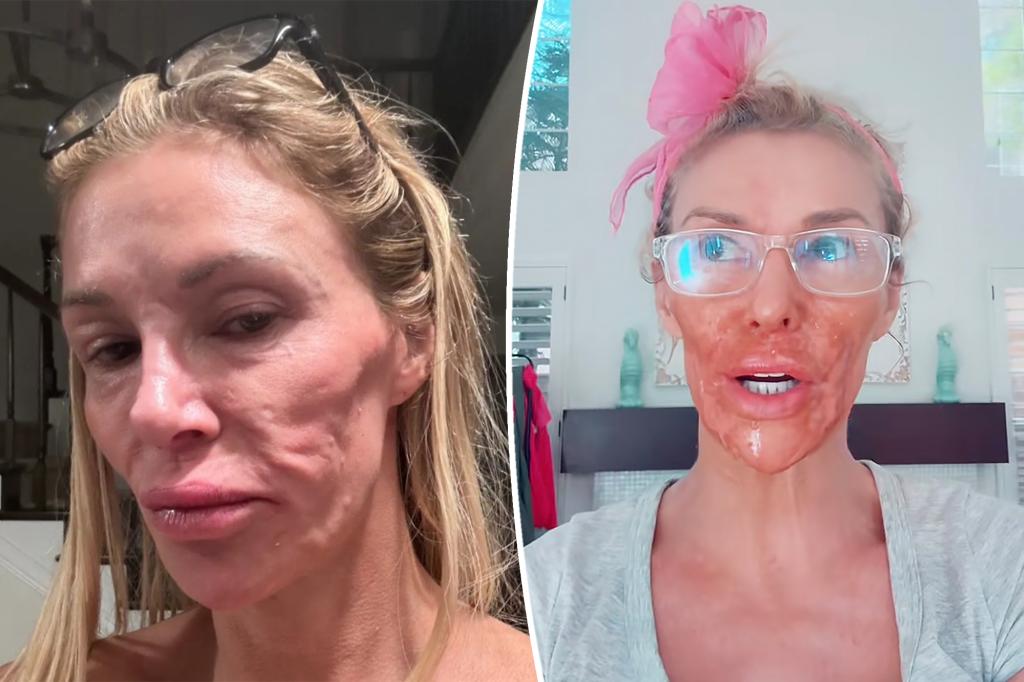 Brandi Glanville gives her facial parasite the name of her 'Real Housewives' rival