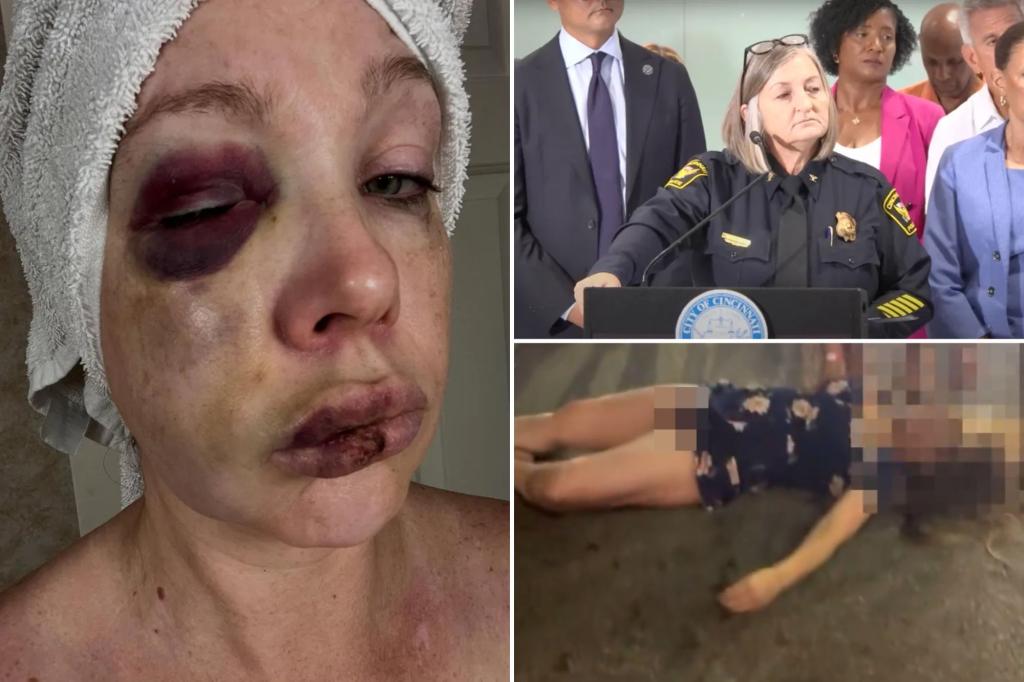 Cincinnati police chief promises to release additional footage of viral fight that left a woman unconscious