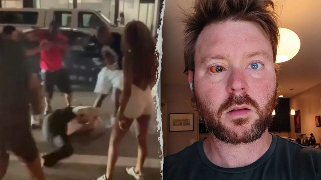 Cincinnati teen crime victim Chris Lewis shares his story after losing an eye