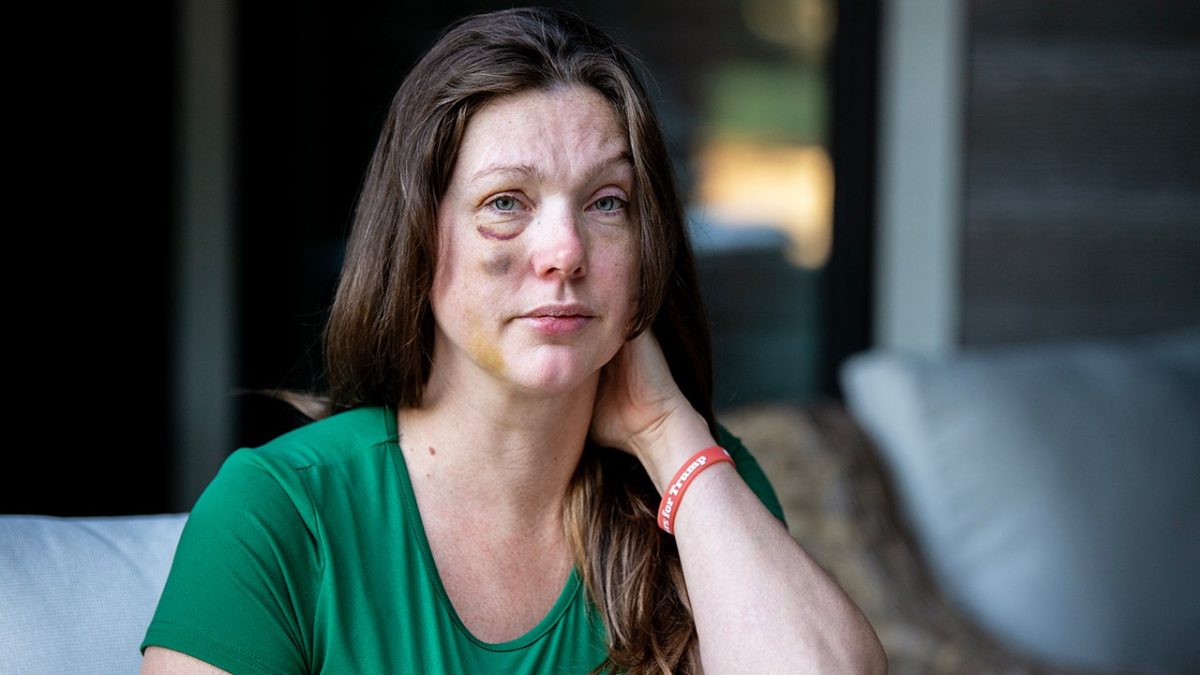 Cincinnati woman shares her story after being assaulted for aiding a victim of an attack.