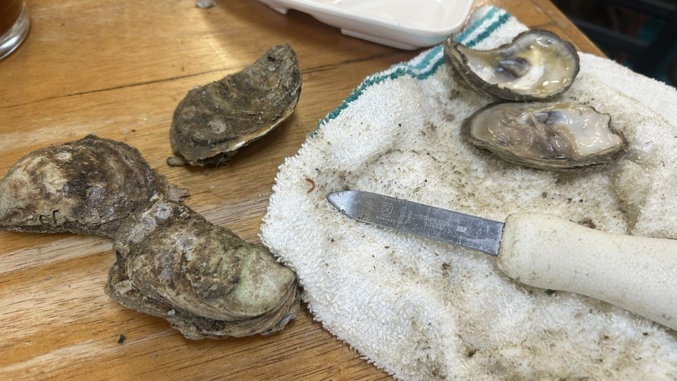 Flesh-eating bacteria claims fifth life in Florida as infections rise to 20 cases