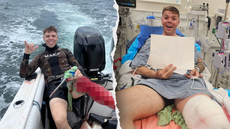 Florida spearfisherman endures bull shark bite and intends to go back ...