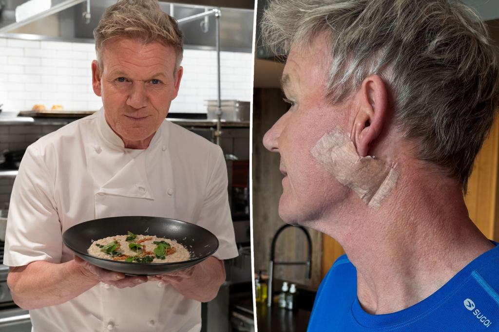 Gordon Ramsay shares his skin cancer diagnosis.