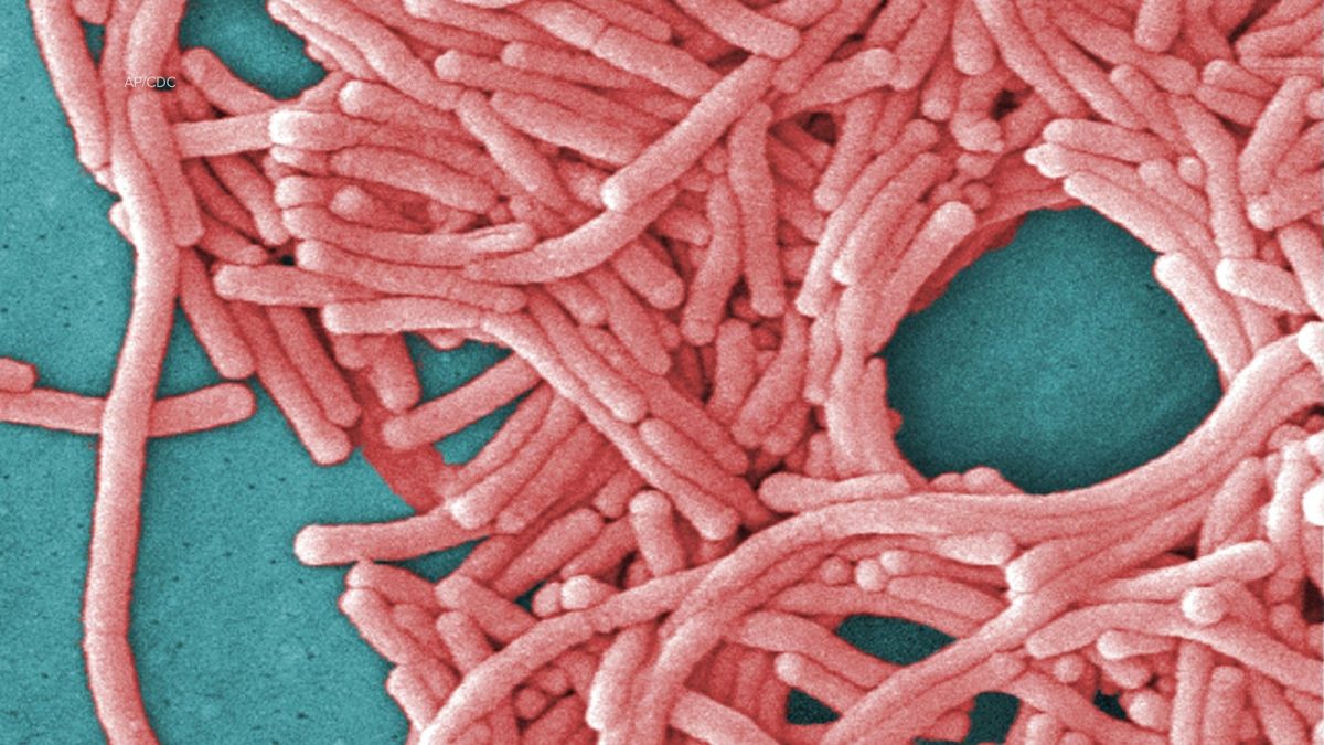 Harlem Legionnaires' outbreak: 2 fatalities reported among 58 cases since July 25
