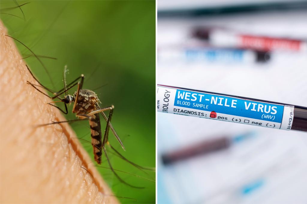 Health authorities verify a human infection of West Nile virus spread by mosquitoes in New Orleans