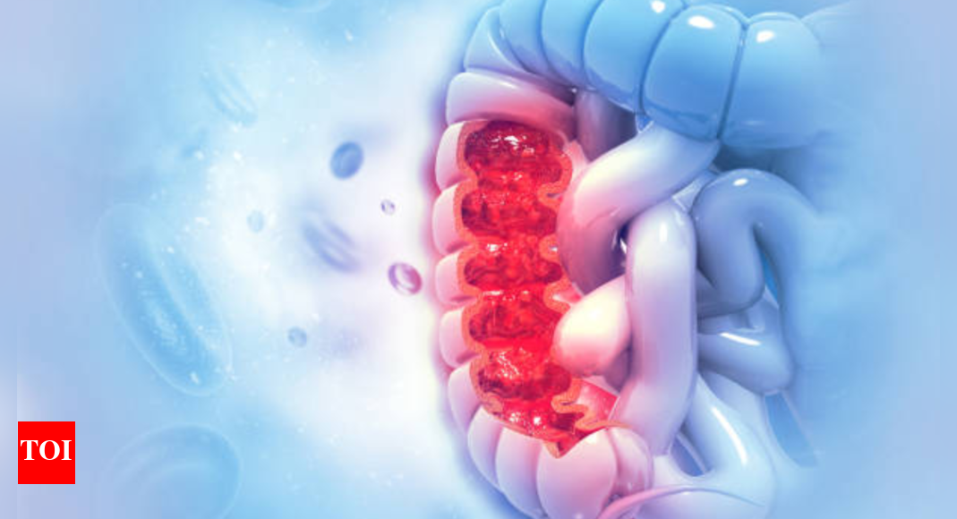 Increase in colon cancer cases among young people: 5 warning signs to watch for