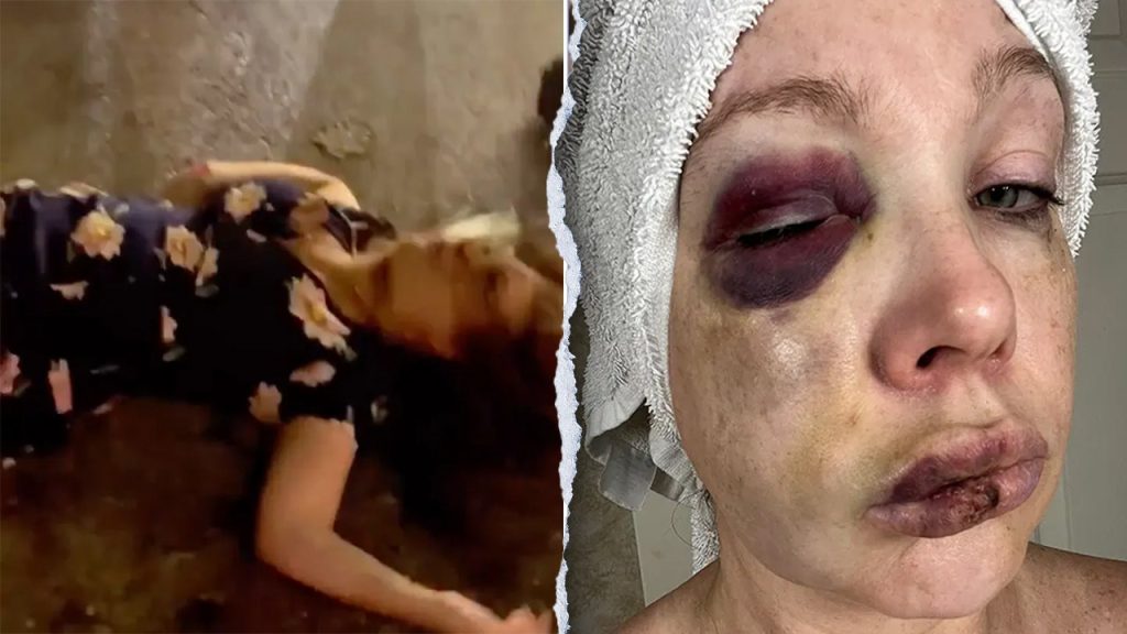 Injured person from Cincinnati fight discusses serious brain injuries and healing process