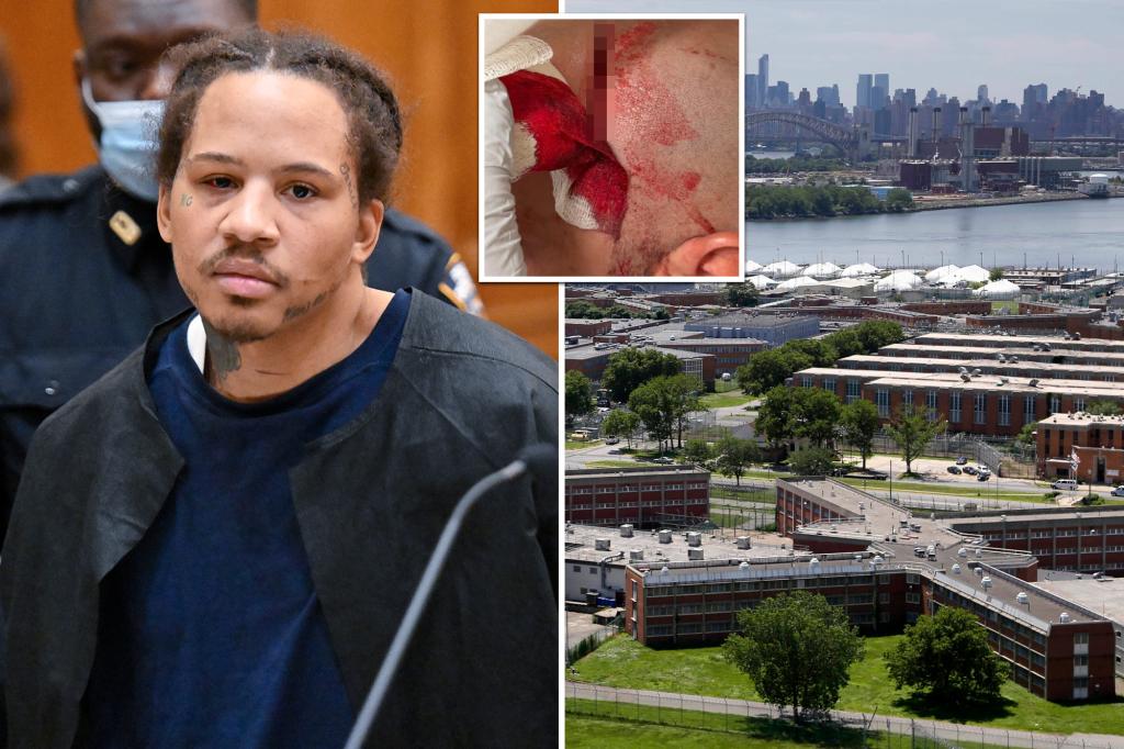 Inmate at Rikers injures two guards in violent scalpel incident, while union leader criticizes Zohran Mamdani