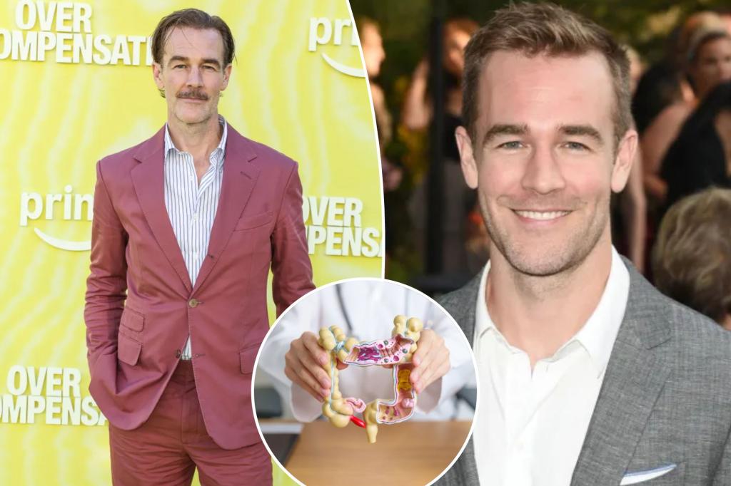 James Van Der Beek shares a colorectal cancer symptom he initially overlooked