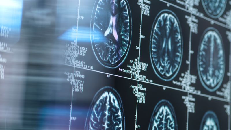 Lithium could help safeguard aging brains against Alzheimer's disease, according to new animal studies.