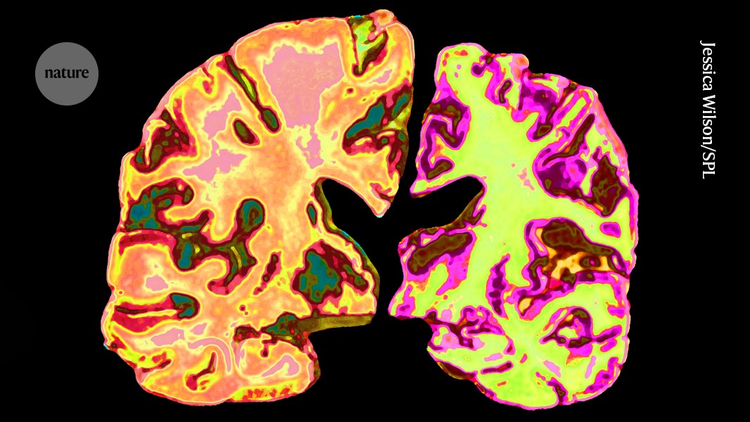 Lithium supplement improves memory in mice