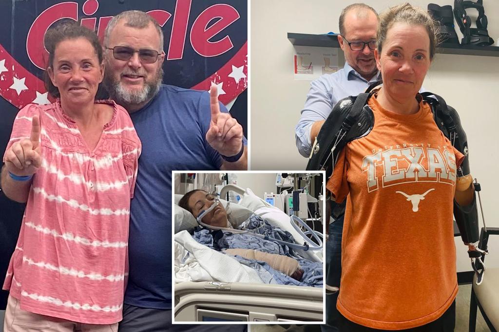 Medicaid refuses to cover prosthetics for Texas woman who lost both arms in a dog attack in 2023