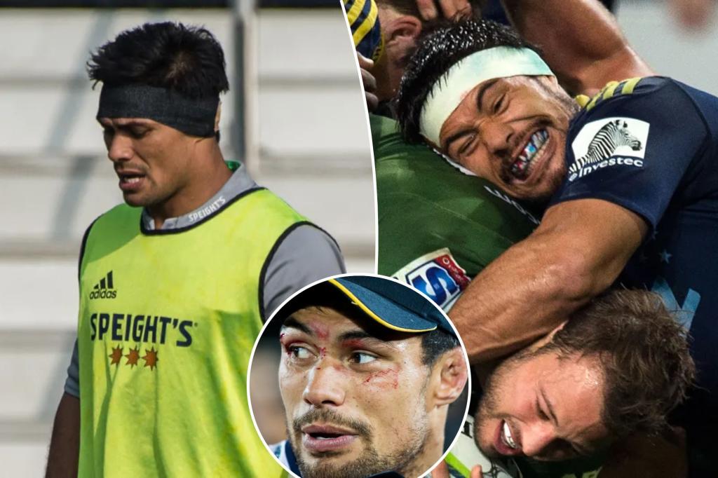 New Zealand rugby player Shane Christie, who advocated for concussion research, has passed away at 39.