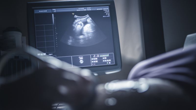 Ob/gyn organization advises Covid-19 vaccines for pregnant women, joining others in diverging from CDC guidance