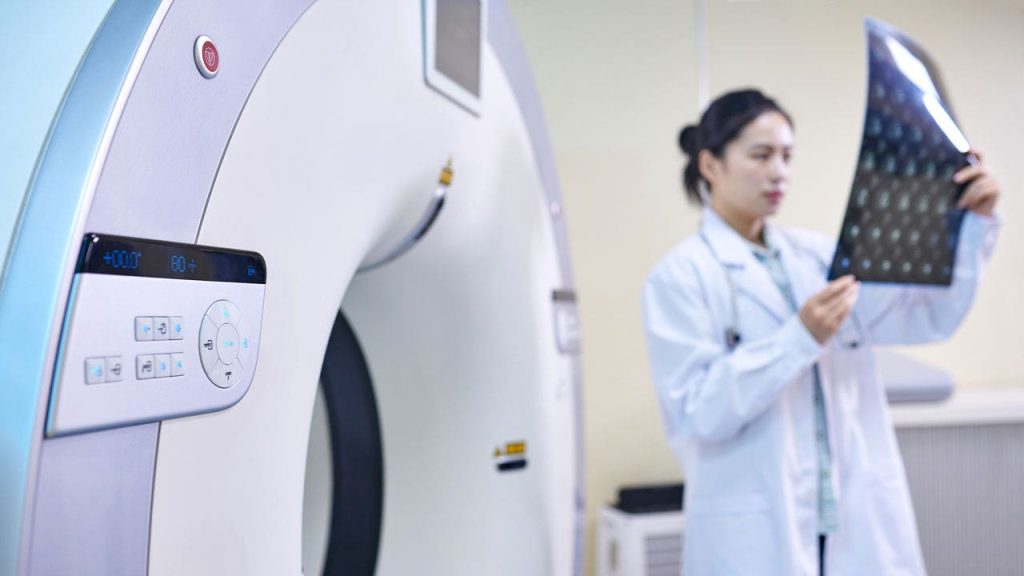 Omega fatty acids might help safeguard women against Alzheimer's disease, research shows.