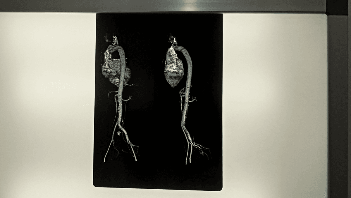 Organs Age At Varied Speeds And Interact Through Secreted Proteins, Highlighting New Avenues For Aging Studies