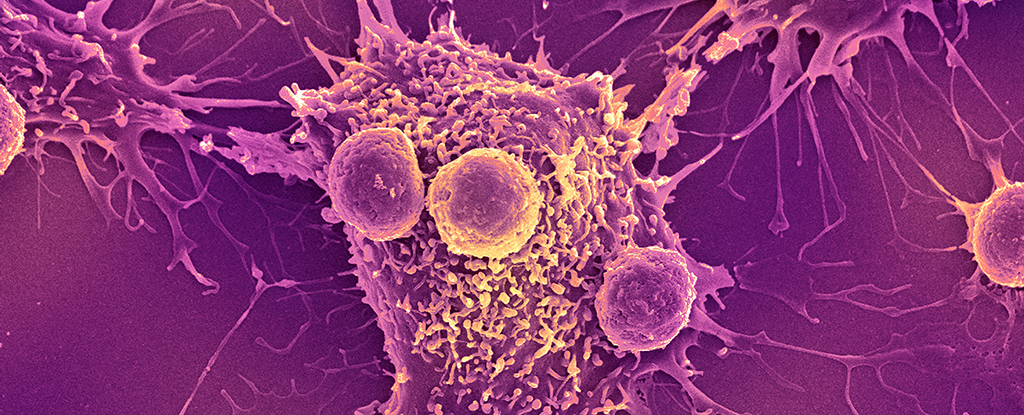 Promising Results from Clinical Trial of New Vaccine for Two Serious Cancers